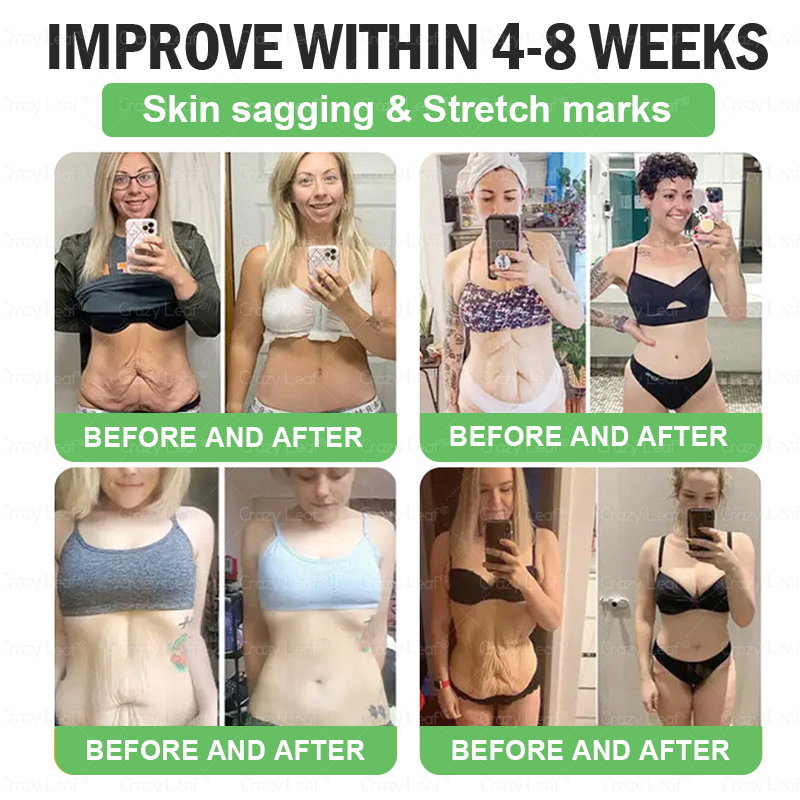 ๐๐ ๐๐๐ช๐ฏ๐ฎ๐๐๐๐ยฎ Only 5 boxes left! We're offering you an additional 50% discount! Get yourself in shape and healthy. Miss out now, and you won't have another chance until next year.