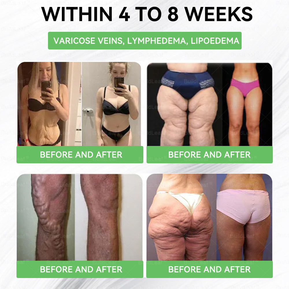 🎁🎁BuildLeaf® Only 5 boxes left! We're offering you an additional 50% discount! Get yourself in shape and healthy. Miss out now, and you won't have another chance until next year.