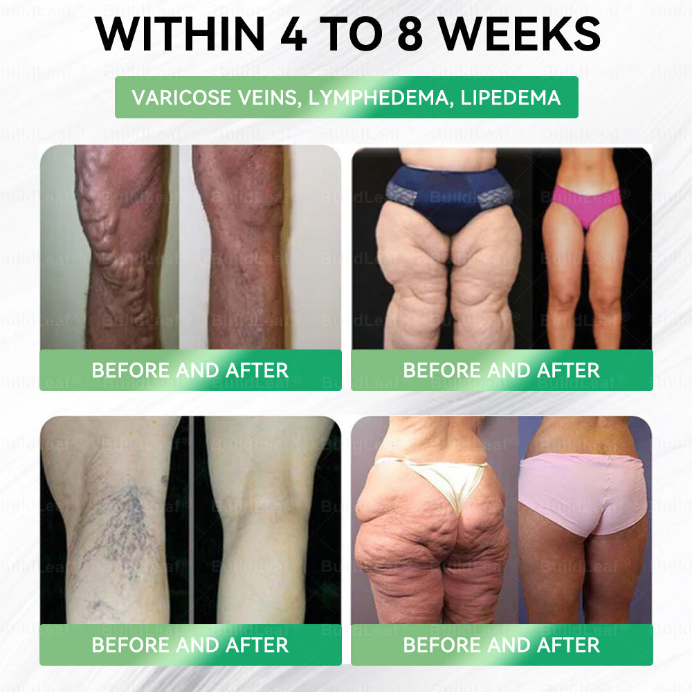 🎁🎁𝘽𝙪𝙞𝙡𝙙𝙇𝙚𝙖𝙛®Only 5 boxes left! We're offering you an additional 30% discount! Get yourself in shape and healthy. Miss out now, and you won't have another chance until next year.