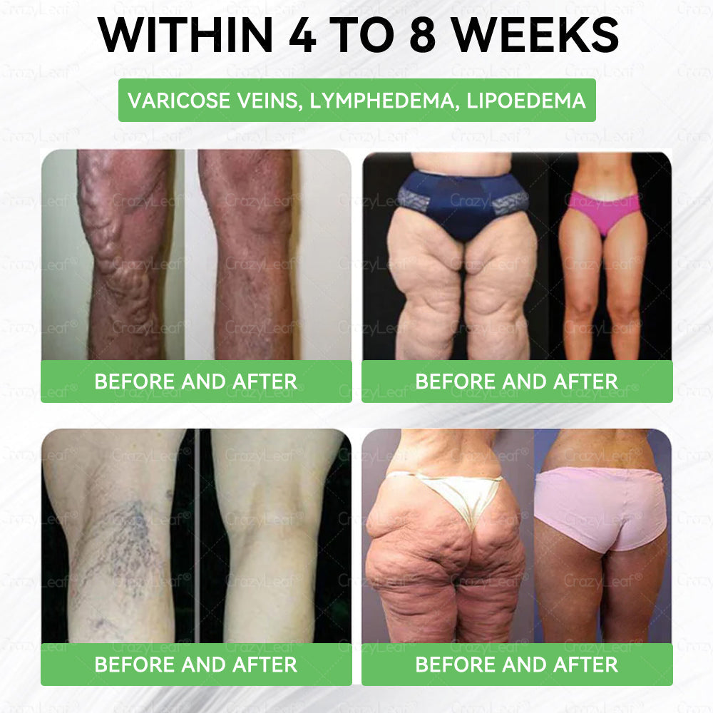 ๐๐ ๐๐๐ช๐ฏ๐ฎ๐๐๐๐ยฎ Only 5 boxes left! We're offering you an additional 50% discount! Get yourself in shape and healthy. Miss out now, and you won't have another chance until next year.