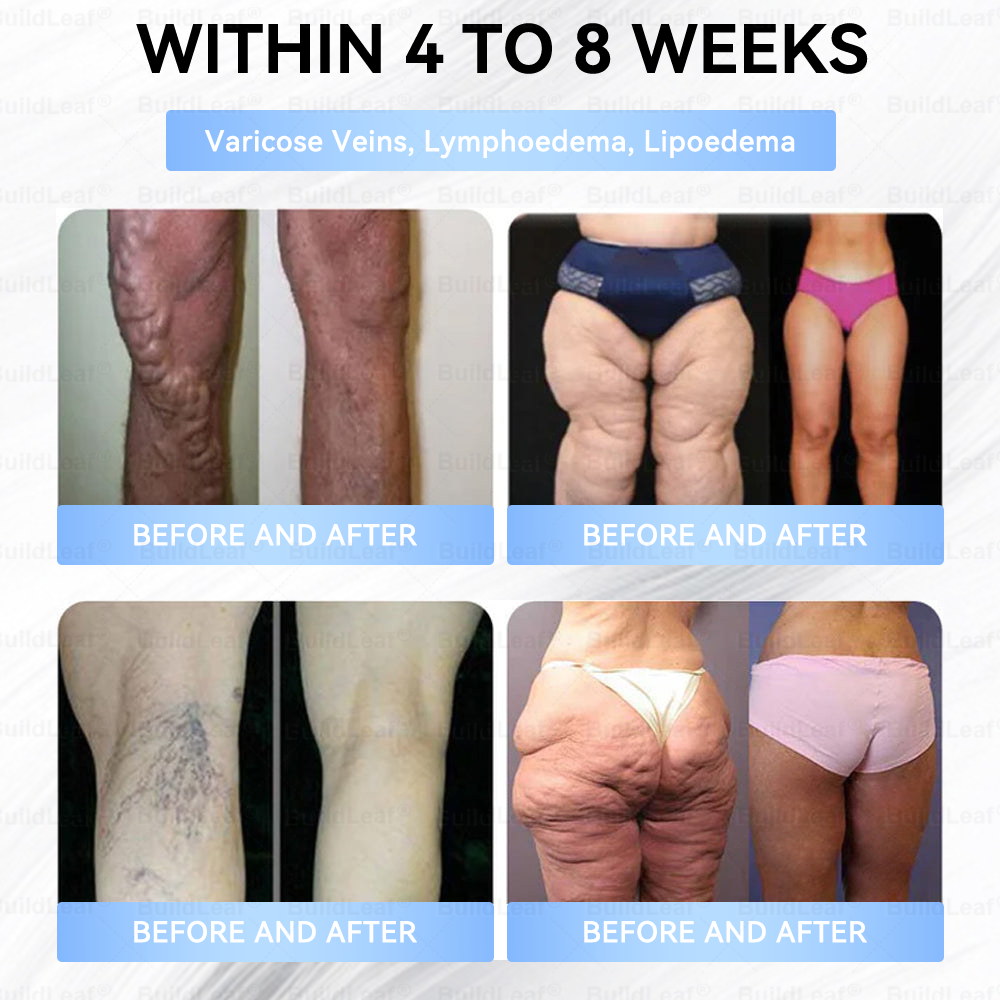 🎁🎁BuildLeaf® Only 5 boxes left! We're offering you an additional 50% discount! Get yourself in shape and healthy. Miss out now, and you won't have another chance until next year.