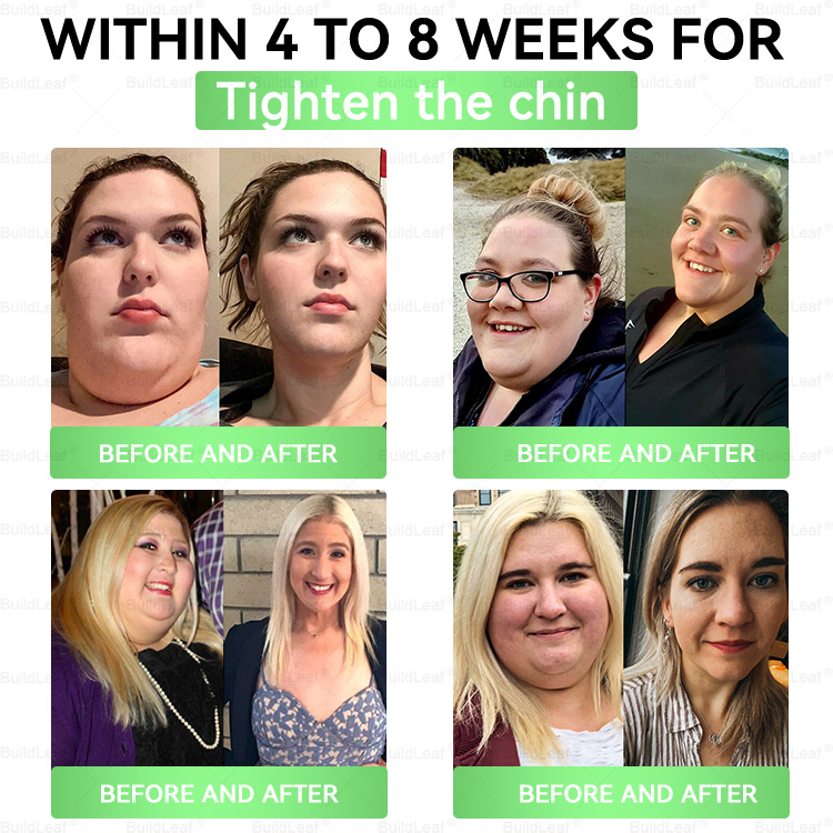 ๐๐๐ฝ๐ช๐๐ก๐๐๐๐๐ยฎOnly 5 boxes left! We're offering you an additional 30% discount! Get yourself in shape and healthy. Miss out now, and you won't have another chance until next year.