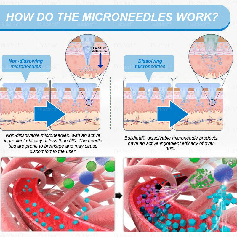 💜FDA Official Store| 𝐵𝑢𝑖𝑙𝑑𝑙𝑒𝑎𝑓® GLP-1 Nano-Microneedle Patch with Collagen & 𝑀𝑎𝑡𝑟𝑖𝑥𝑦𝑙 3000 丨𝑇𝑎𝑟𝑔𝑒𝑡𝑠 𝑂𝑏𝑒𝑠𝑖𝑡𝑦, 𝐿𝑜𝑜𝑠𝑒 𝑆𝑘𝑖𝑛, 𝐻𝑖𝑔ℎ 𝐵𝑙𝑜𝑜𝑑 𝑃𝑟𝑒𝑠𝑠𝑢𝑟𝑒, 𝐷𝑖𝑎𝑏𝑒𝑡𝑒𝑠, 𝐹𝑎𝑡𝑡𝑦 𝐿𝑖𝑣𝑒𝑟, 𝐽𝑜𝑖𝑛𝑡 𝑃𝑎𝑖𝑛, 𝐵𝑟𝑎𝑖𝑛 𝐹𝑜𝑔, 𝐿𝑜𝑤 𝐸𝑛𝑒𝑟𝑔𝑦, 𝐵𝑜𝑑𝑦 𝐴𝑐ℎ𝑒𝑠, 𝑎𝑛𝑑 𝑀𝑜𝑟𝑒🔥🔥