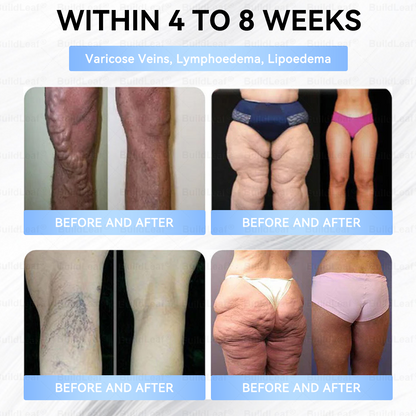 🎁🎁BuildLeaf® Only 5 boxes left! We're offering you an additional 50% discount! Get yourself in shape and healthy. Miss out now, and you won't have another chance until next year.