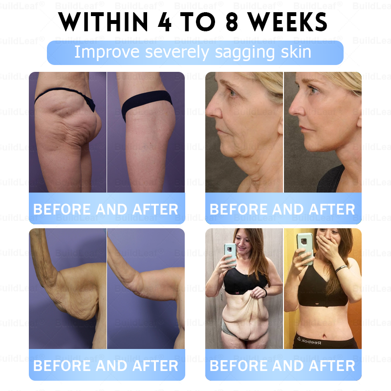 🎁🎁BuildLeaf® Only 5 boxes left! We're offering you an additional 50% discount! Get yourself in shape and healthy. Miss out now, and you won't have another chance until next year.