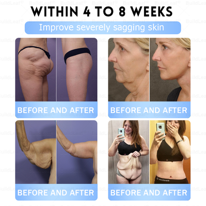 🎁🎁BuildLeaf® Only 5 boxes left! We're offering you an additional 50% discount! Get yourself in shape and healthy. Miss out now, and you won't have another chance until next year.